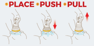 how to use the lifevac choking device